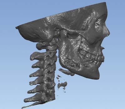 Рис. 3. Модель черепа