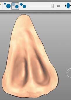 Рис. 7. Внутренняя часть протеза носа, созданная с учетом наличия воздушных каналов