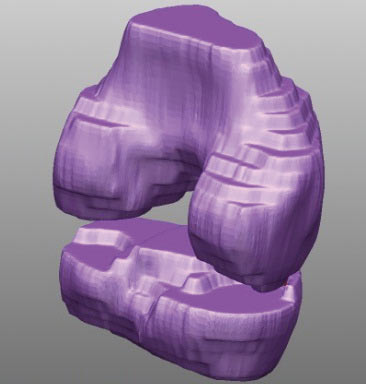 Рис. 3. Триангуляционная 3D-модель коленного сустава