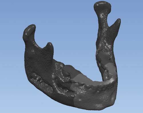 Рис. 5. Разрезанная на три части CAD-модель челюсти
