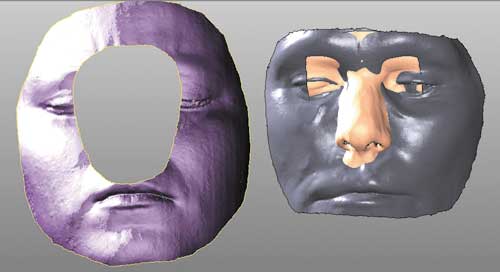 Рис. 4. Перемещение «донорского» носа на 3D-модель лица пациентки