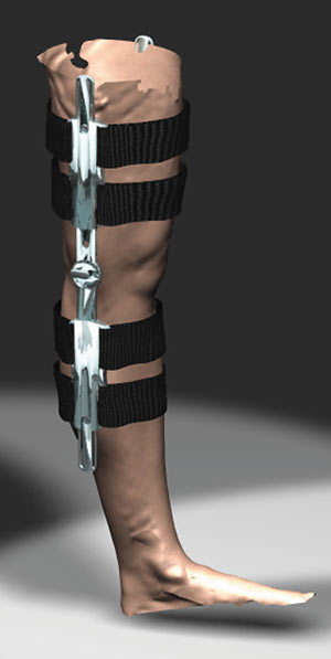 Рис. 7. Модель ноги человека с наложением ремней крепления ортеза