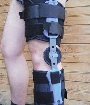 Ортез коленного сустава